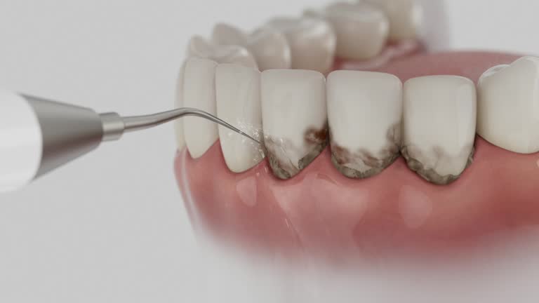 Reliable Dental Implants contractor in South Beloit, IL by Smile Center Dentistry